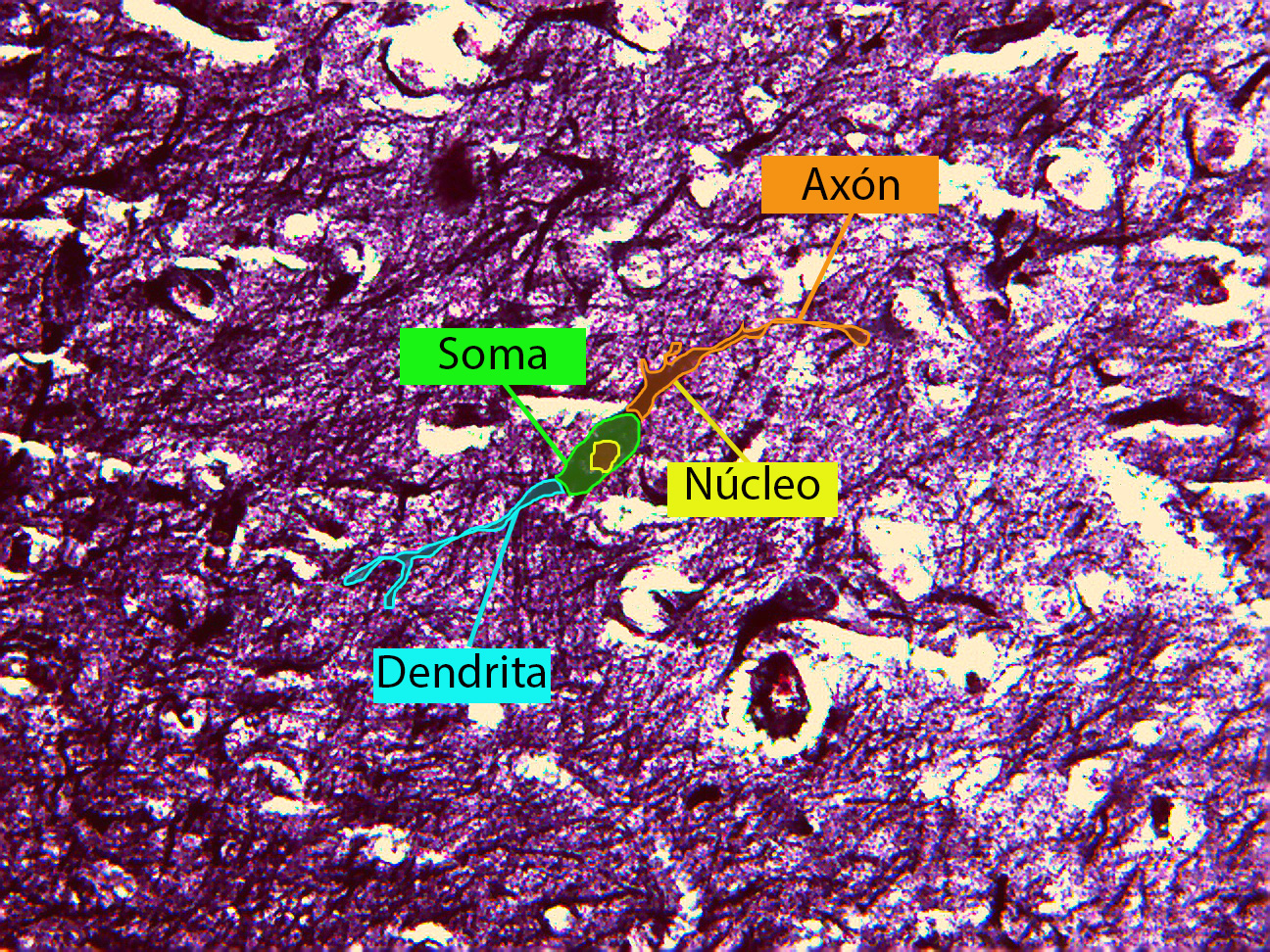 Cerebro: Neurona Fusiforme